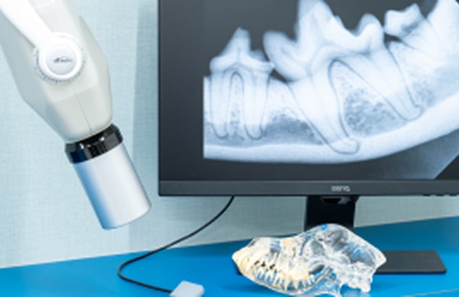 歯のレントゲンの写真