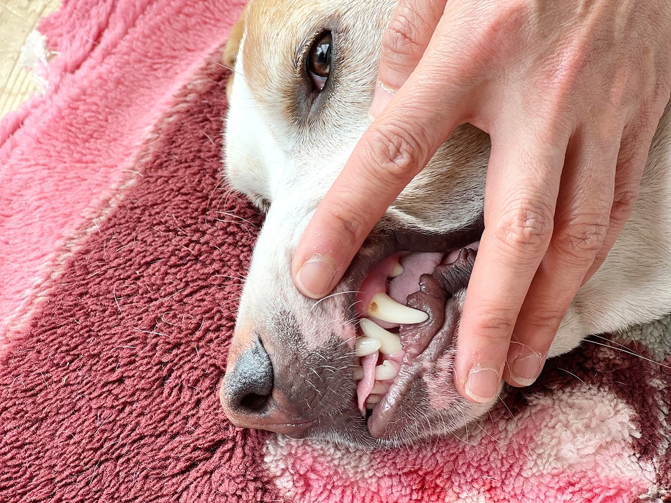 歯の破折の説明画像