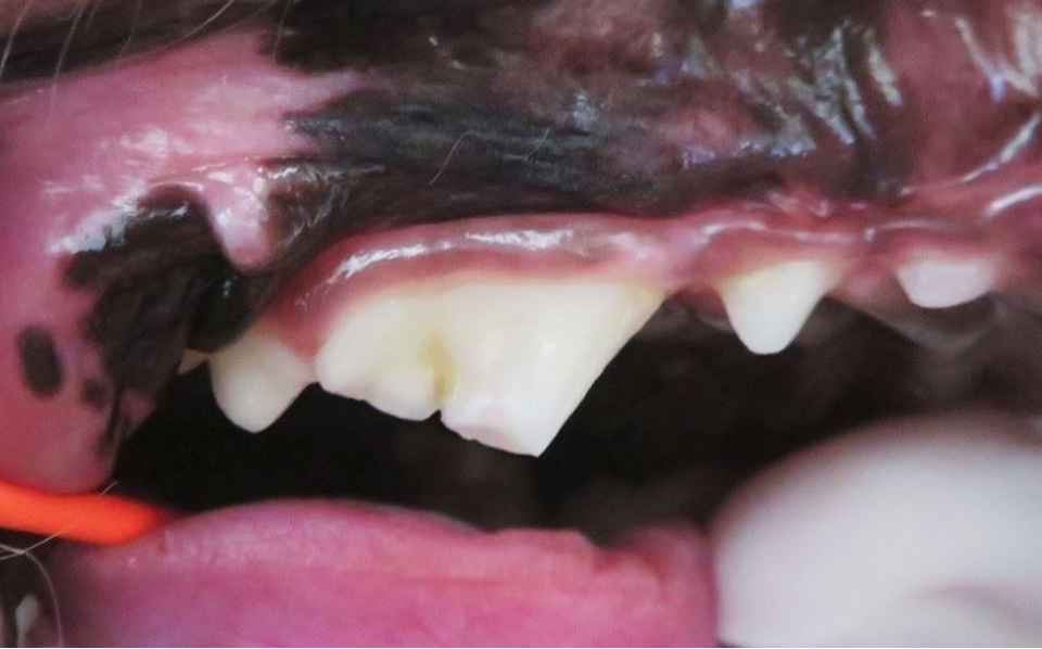 歯冠破折の処置前写真