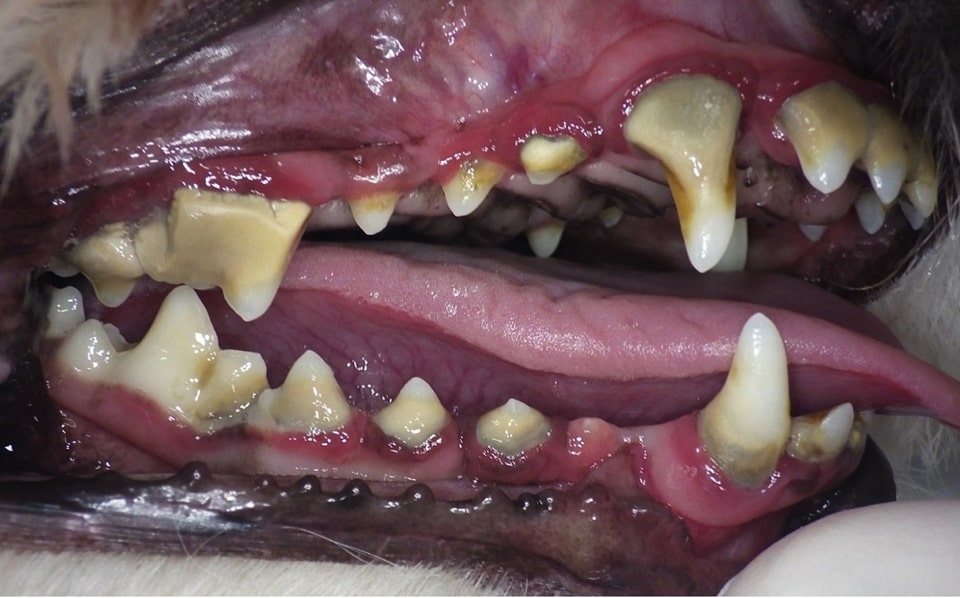 中度歯周病の処置前写真