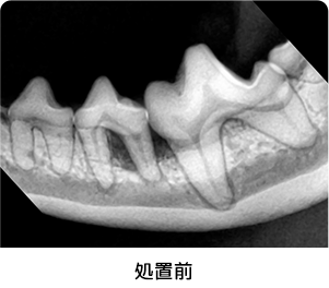 重度歯周病_処置前イメージ